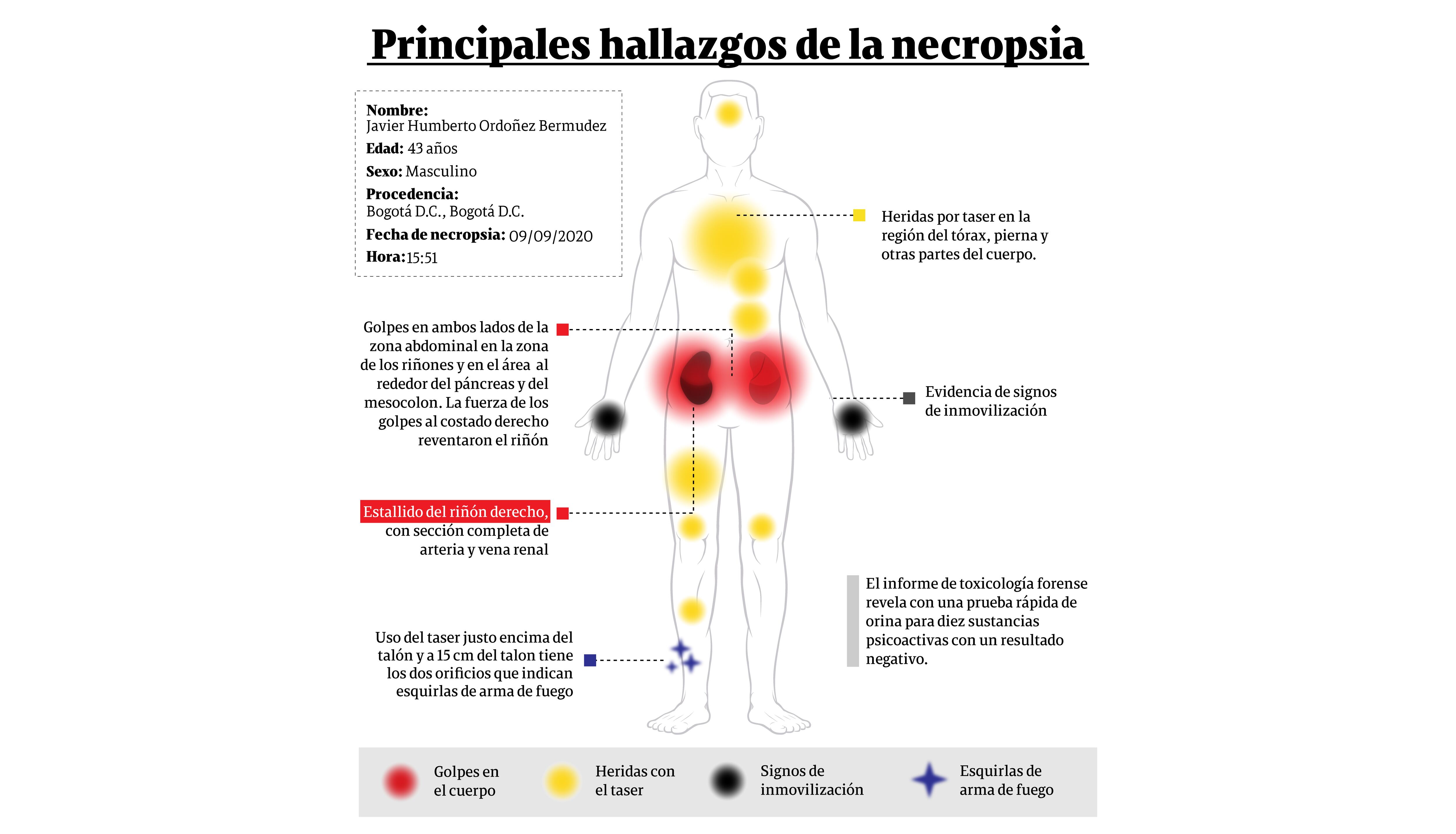 Necropsia Javier Ordóñez
