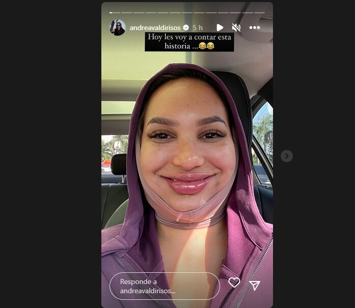 La influencer reveló qué fue lo que se hizo en su cara