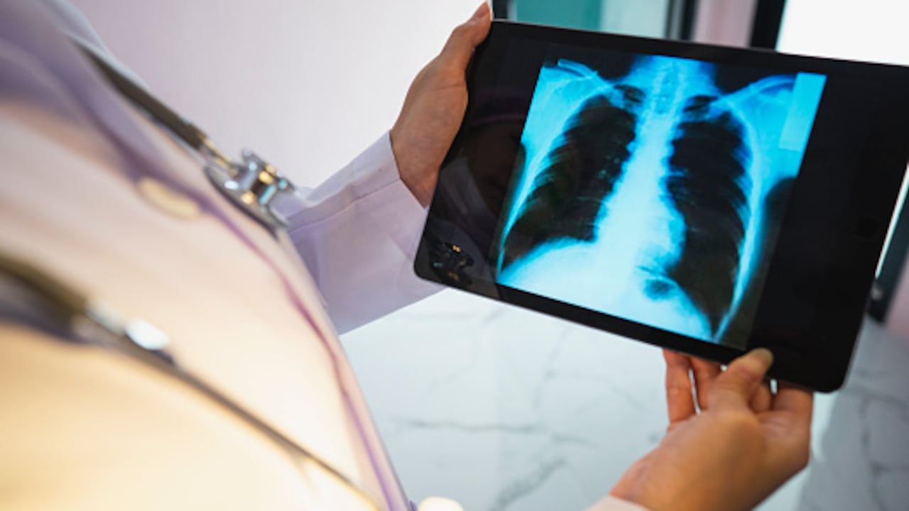 Los distintos tipos de cáncer son algunas de las enfermedades más mortales para los latinos.