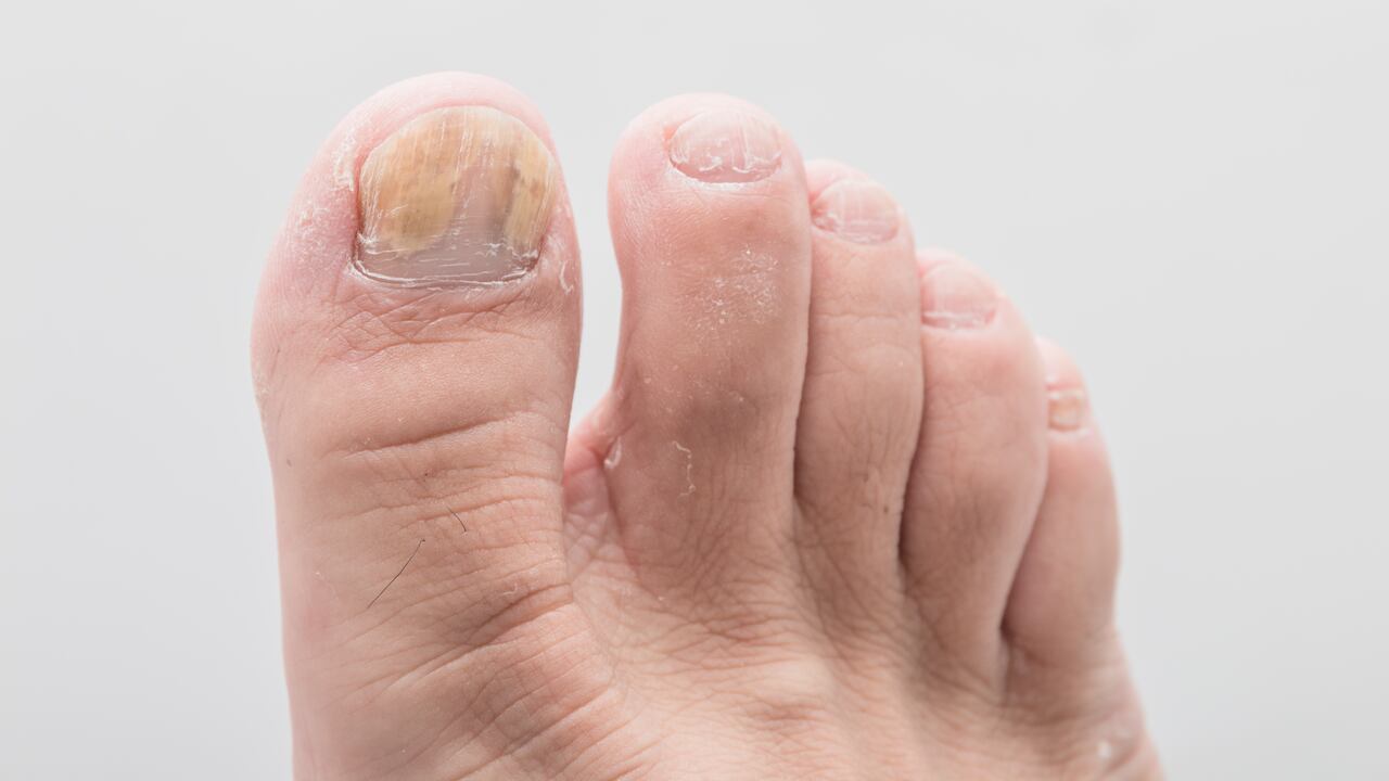 La Organización Mundial para la Salud (OMS) dice que "los tipos de cáncer más comunes son los de mama, pulmón, colon y recto y próstata".