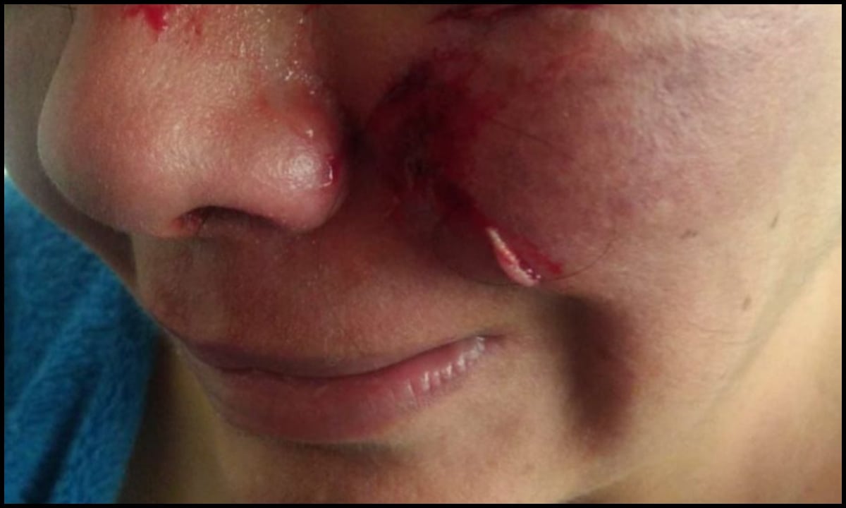 Según denuncia la famiia de Heidy Saldaña, en varias oportunidades la mujer con ELA recibió malos tratos y procedimeintos del personal de la IPS