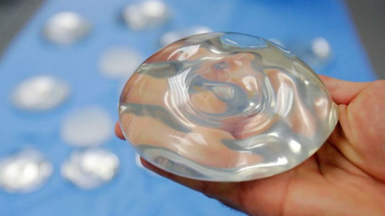 El cáncer es inusual. La FDA ha registrado un total de 733 casos relacionados con implantes, entre decenas de miles de cirugías realizadas al año.