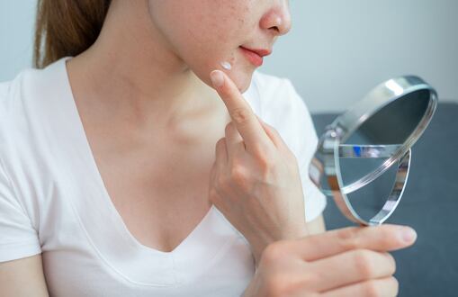 Mascarillas con ajo que ayudan a combatir el acné.