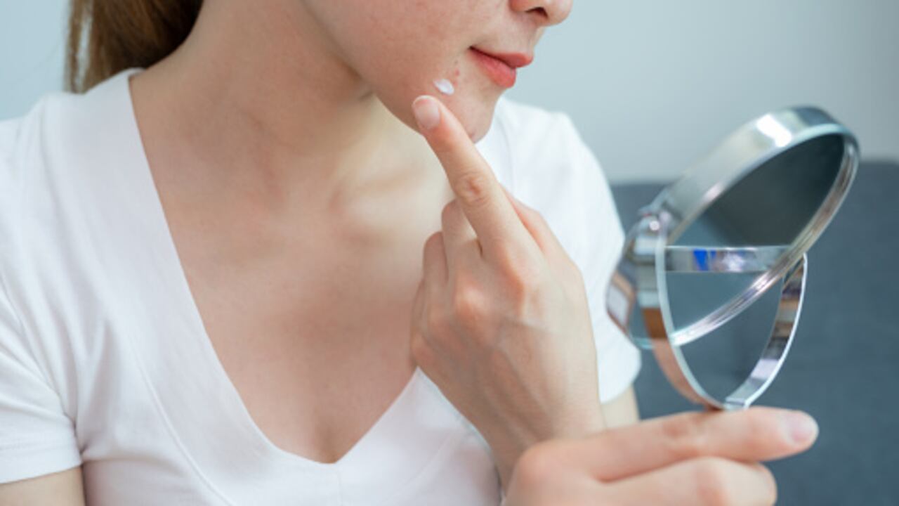 El uso de mascarillas ayuda a prevenir los problemas de acné