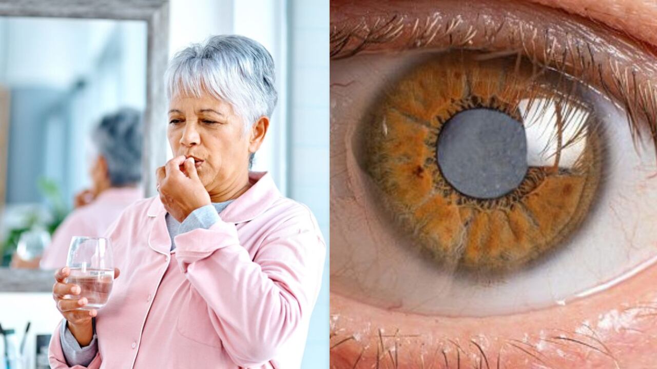 La vitamina que combate las cataratas y el glaucoma.