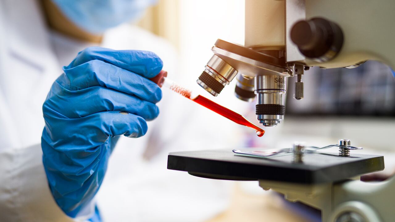 Pruebas de laboratorio - Foto de referencia