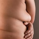 Contra la obesidad: convertir la grasa mala en buena, foto: Thinkstock