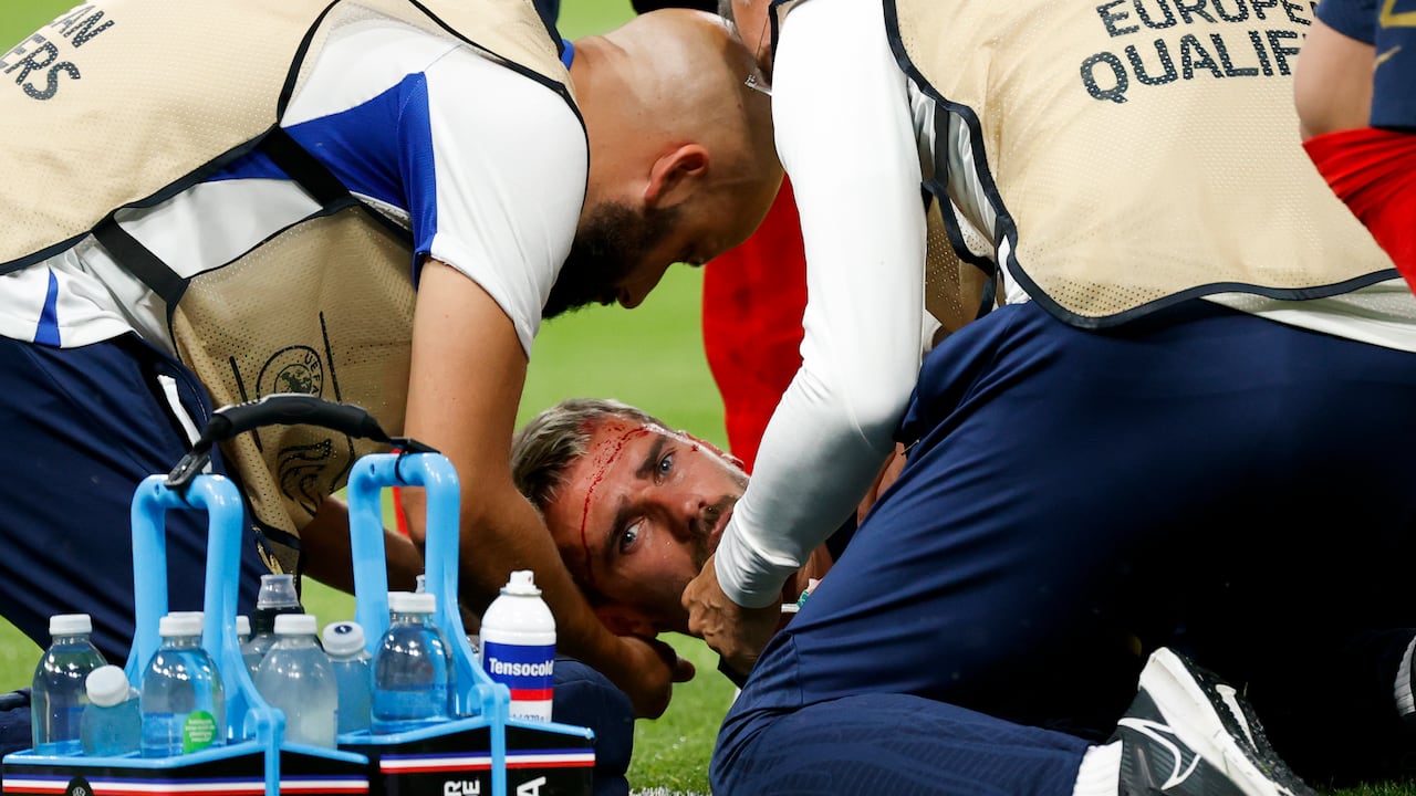 Antoine Griezmann #7 de Francia se lesiona durante el partido del grupo B de la ronda de clasificación de la UEFA EURO 2024 entre Francia y Grecia en el Stade de France. (Photo by Catherine Steenkeste/Getty Images)