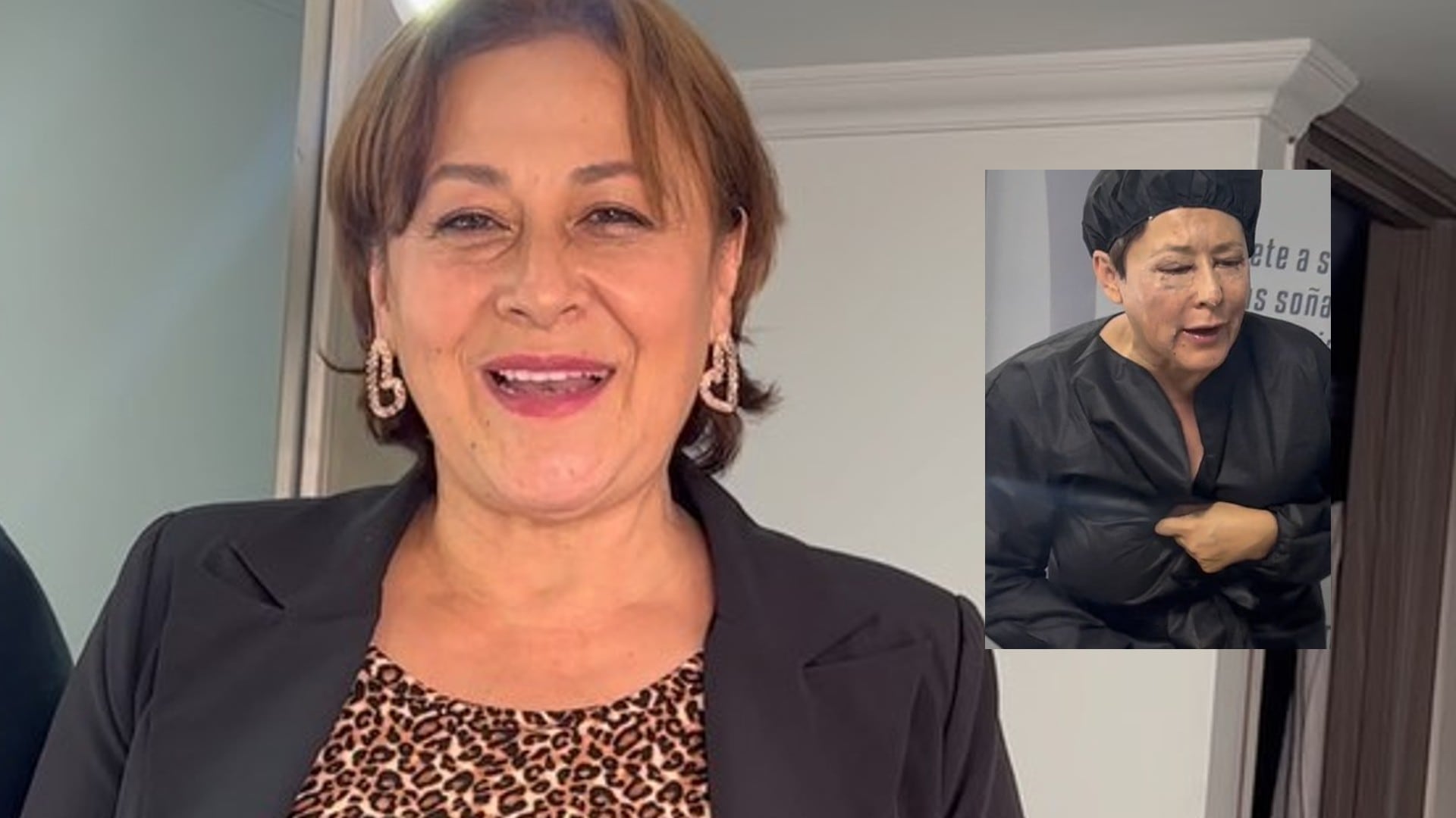 Estos fueron los procedimientos que se hizo Alina Lozano para verse más joven.