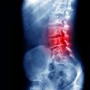 Foto de referencia de la médula espinal