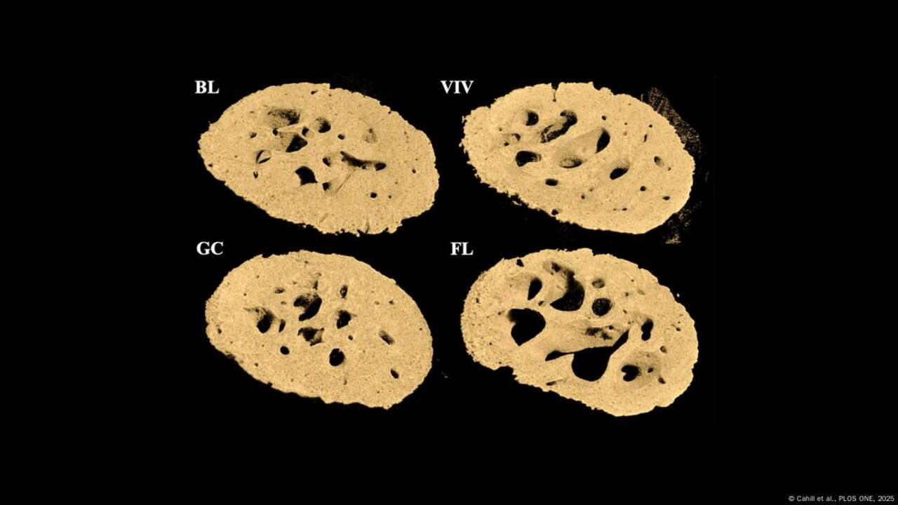 Investigadores descubrieron que la pérdida estructural no afecta por igual a todas las zonas.
