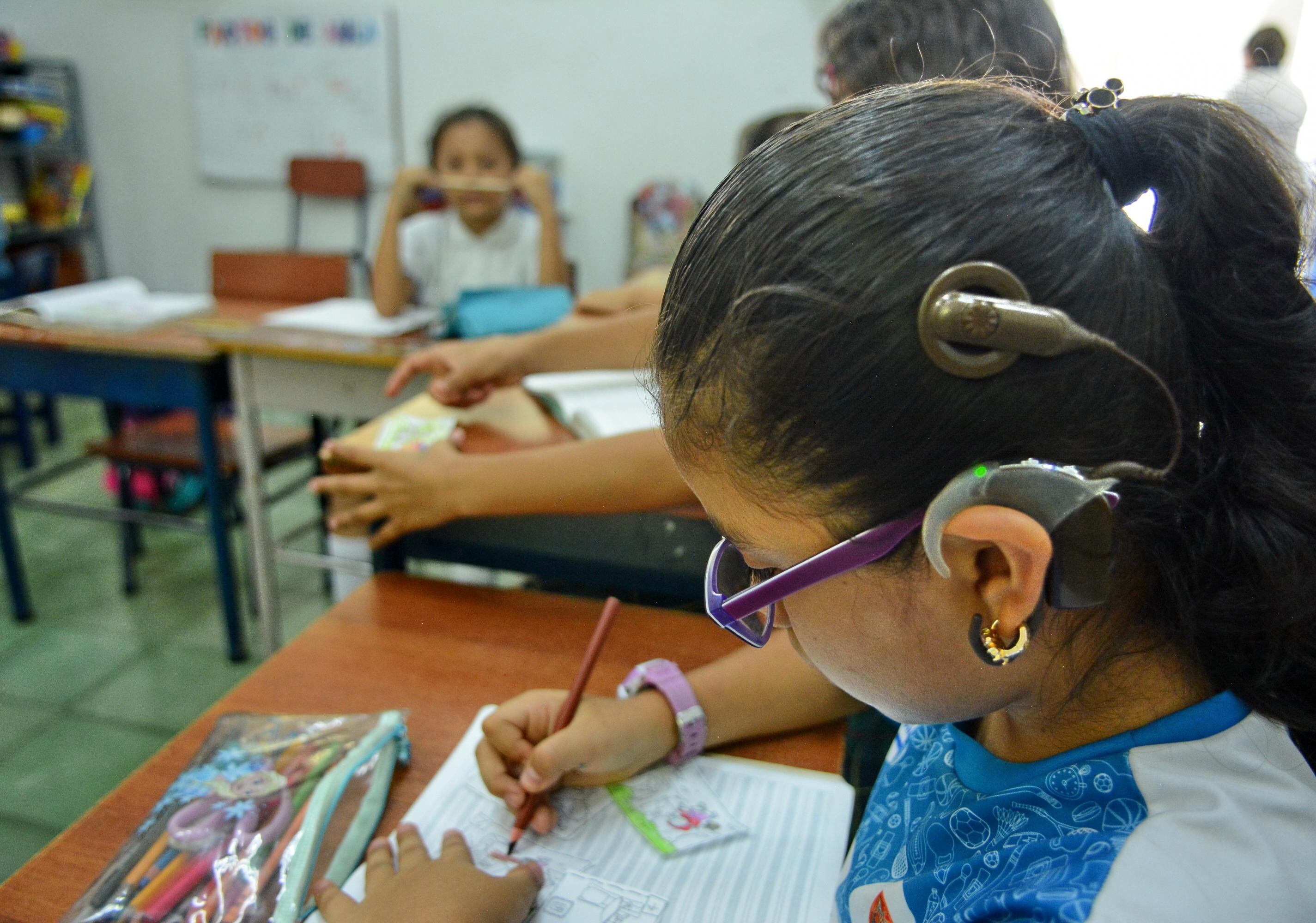 Los niños tienen clase desde las 8:00 a.m. hasta las 3:00 p.m. A aquellos que tienen una discapacidad auditiva se les realizan implantes cocleares, que sirven para transformar las señales acústicas en señales eléctricas que estimulan el nervio auditivo.