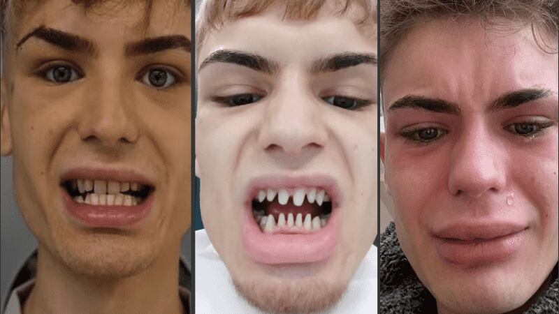 Joven con diseño de sonrisa fallido