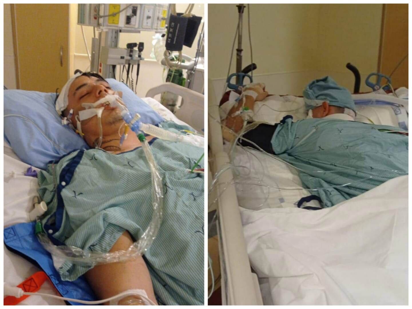 El joven se encuentra en coma inducido.