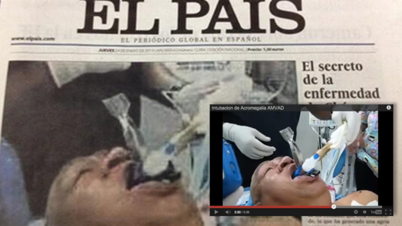 Portada de El País y fotograma de un video donde se realiza una intubación.