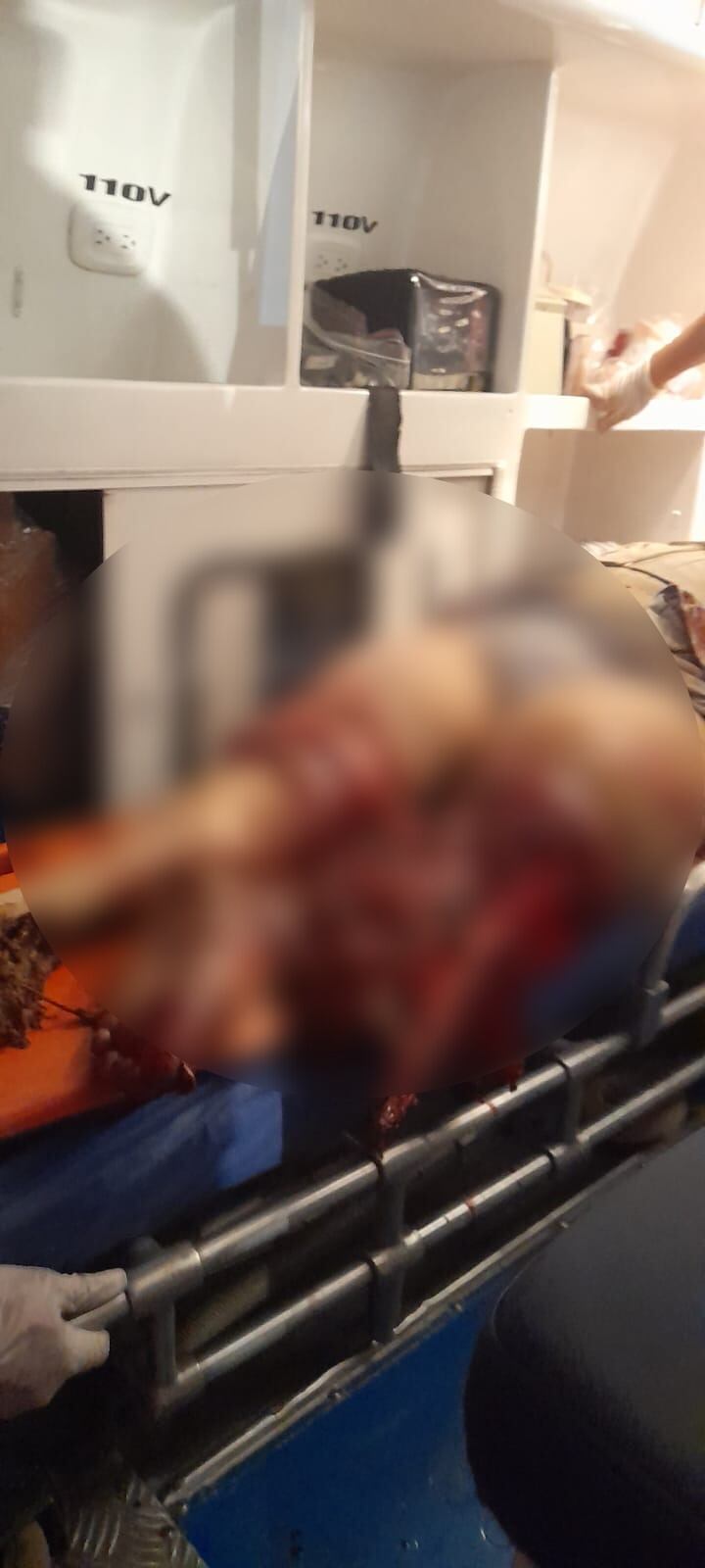 Por esquivar un hueco, la motociclista perdió el control.