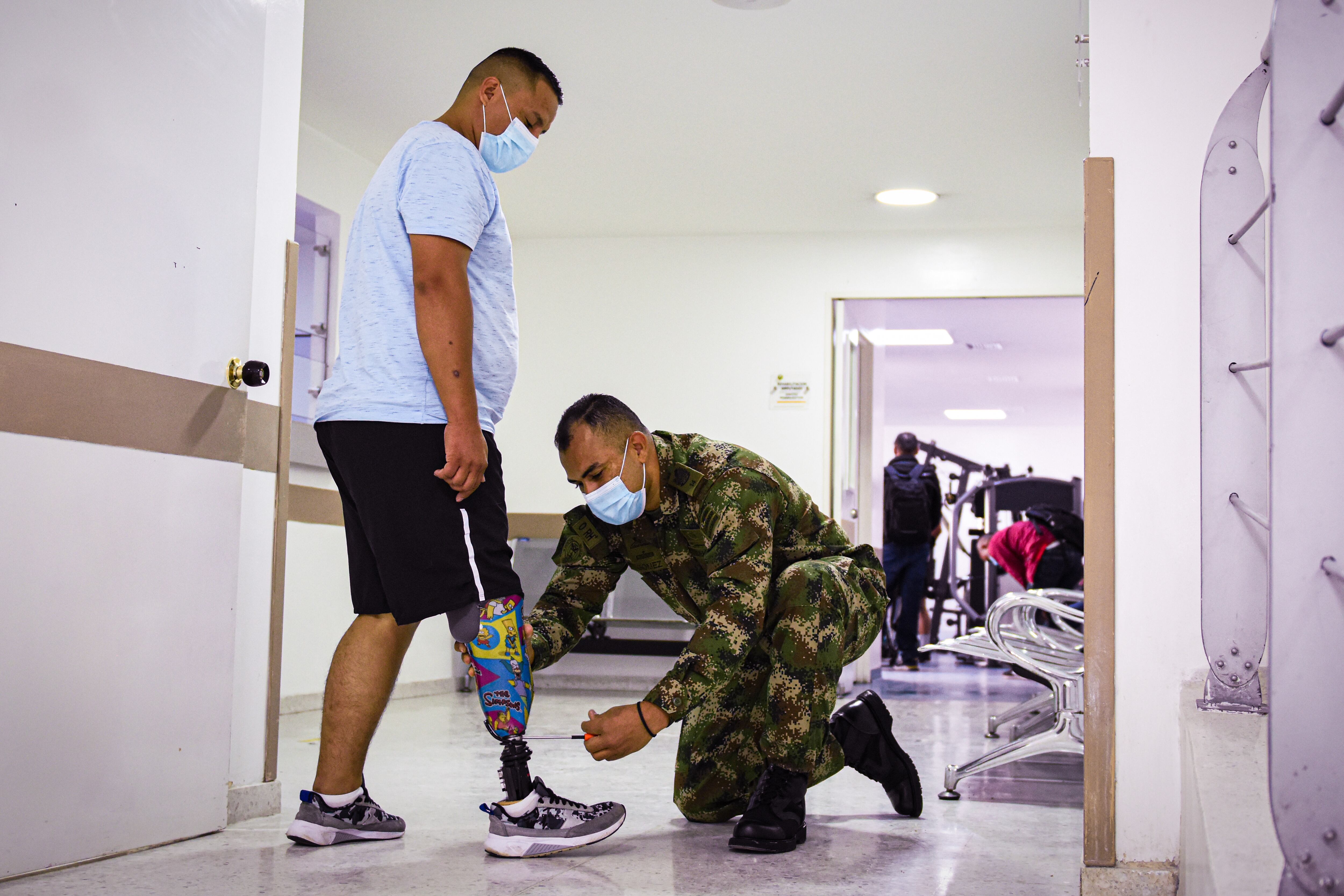 Elaboración de Protesis minas antipersona