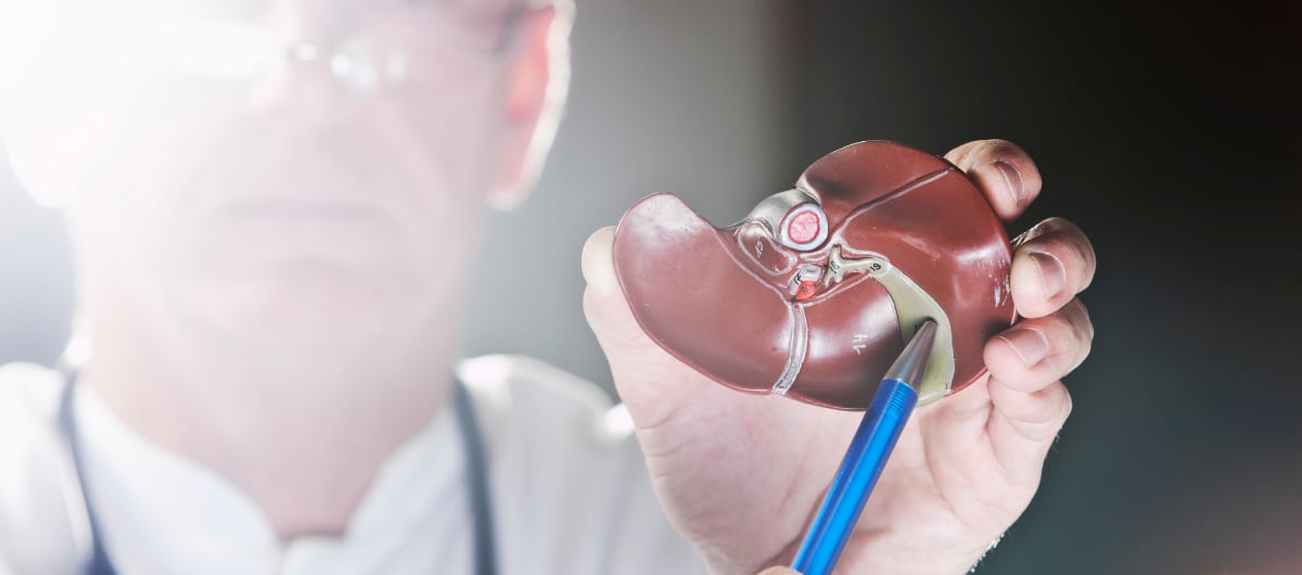 Foto de referencia del hígado