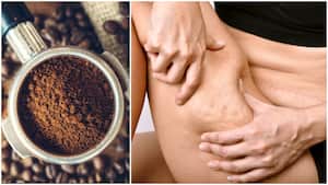 El café contiene un mundo de propiedades que pueden mejorar significativamente la salud y vitalidad de la piel