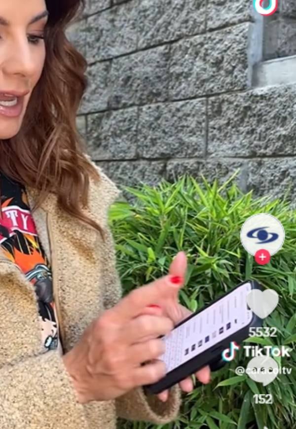 La celebridad fue criticada por el aspecto de sus manos.