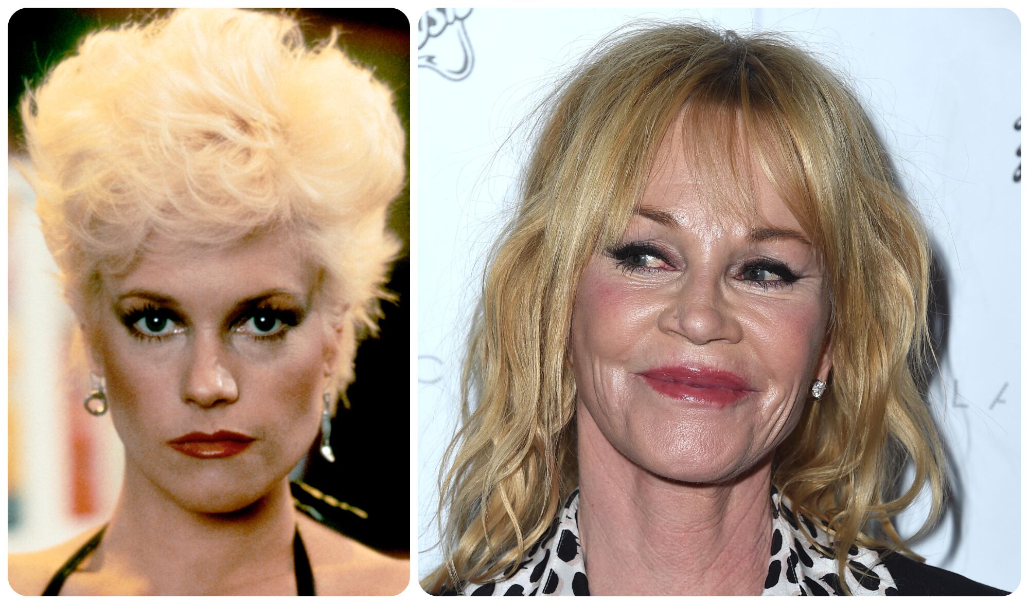 Niega rotundamente haberse hecho alguna cirugía o arreglo estético aunque es muy evidente.