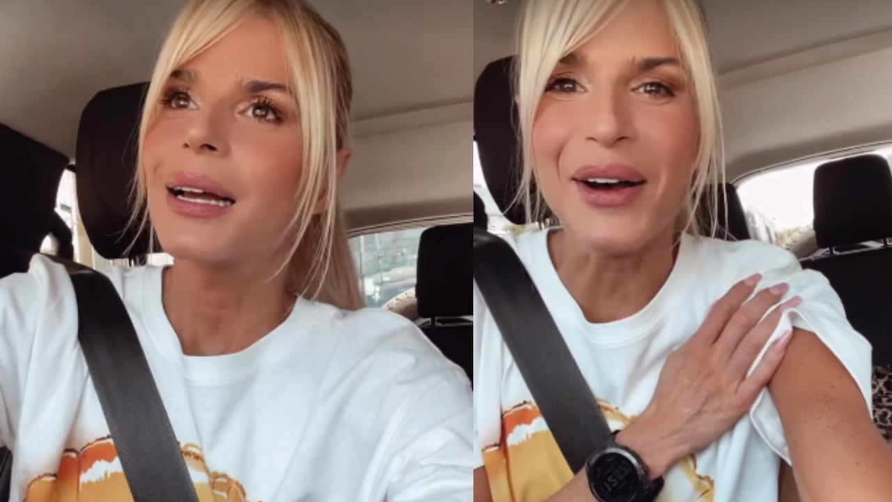 Mary Méndez mostró la mancha que quedó en su brazo por no aplicar adecuadamente el autobronceador.