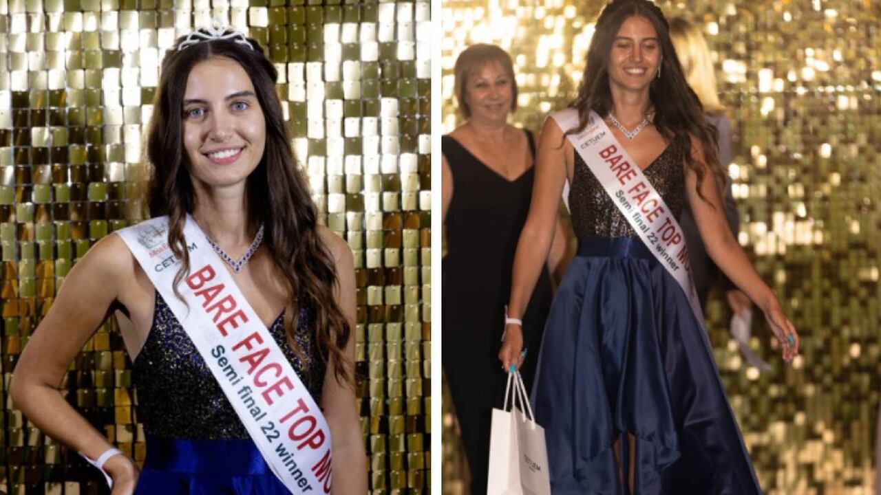 La candidata afirma que busca desafiar los estándares de belleza establecidos. Foto: Instagram @dk_pixels_uk @missenglandofficial.