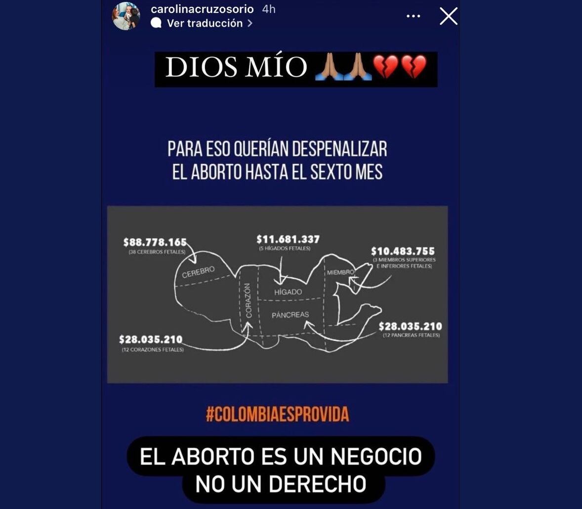 “El aborto es un negocio, no un derecho”, escribió Carolina Cruz en la imagen que publicó. Foto: Instagram @carolinacruzosorio