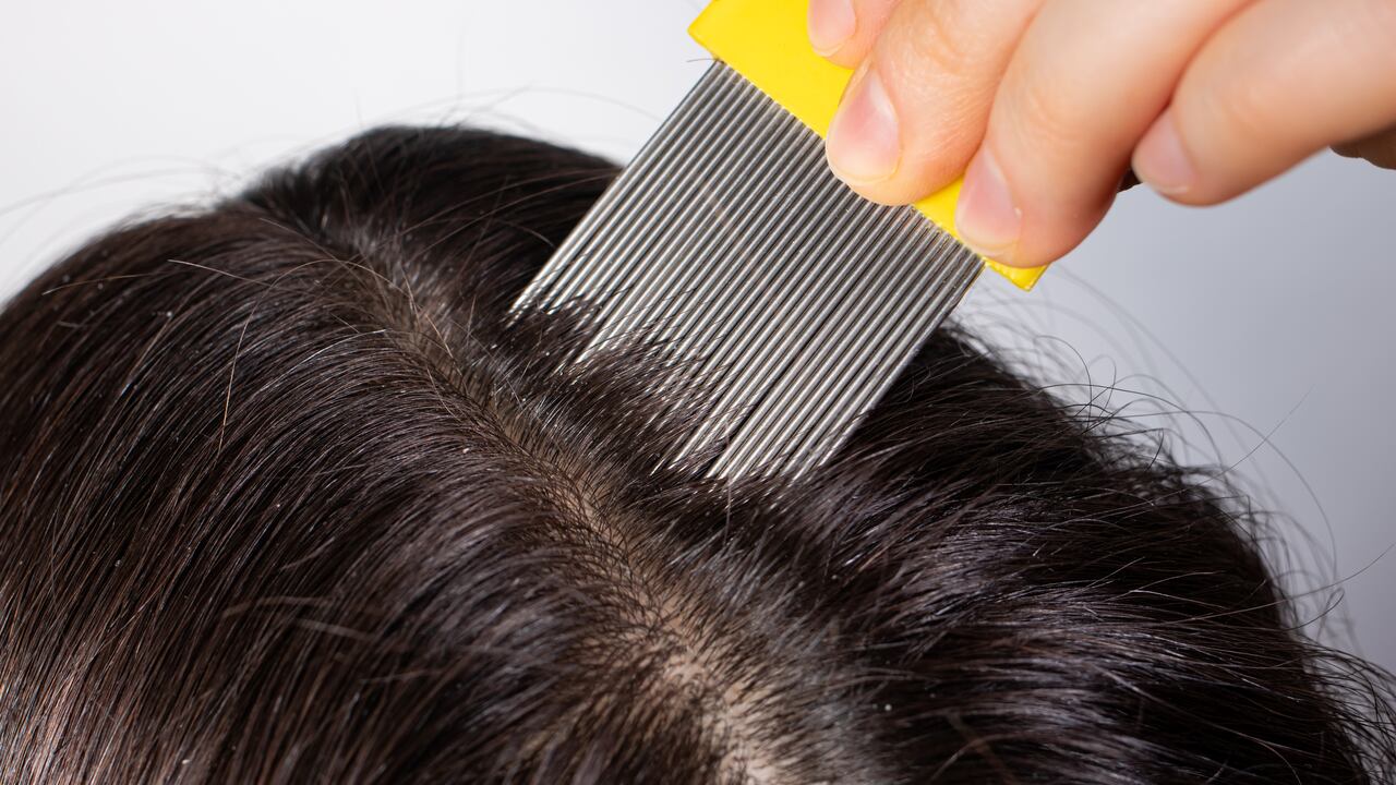 Los piojos también pueden tenerlos los adultos.