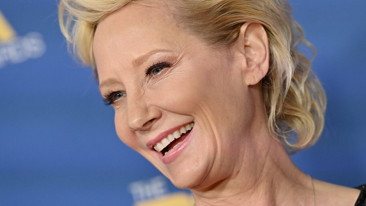 Heche sufrió fracturas, quemaduras e inhaló humo tóxico en medio de su accidente, lo que habría convergido para su terrible desenlace.