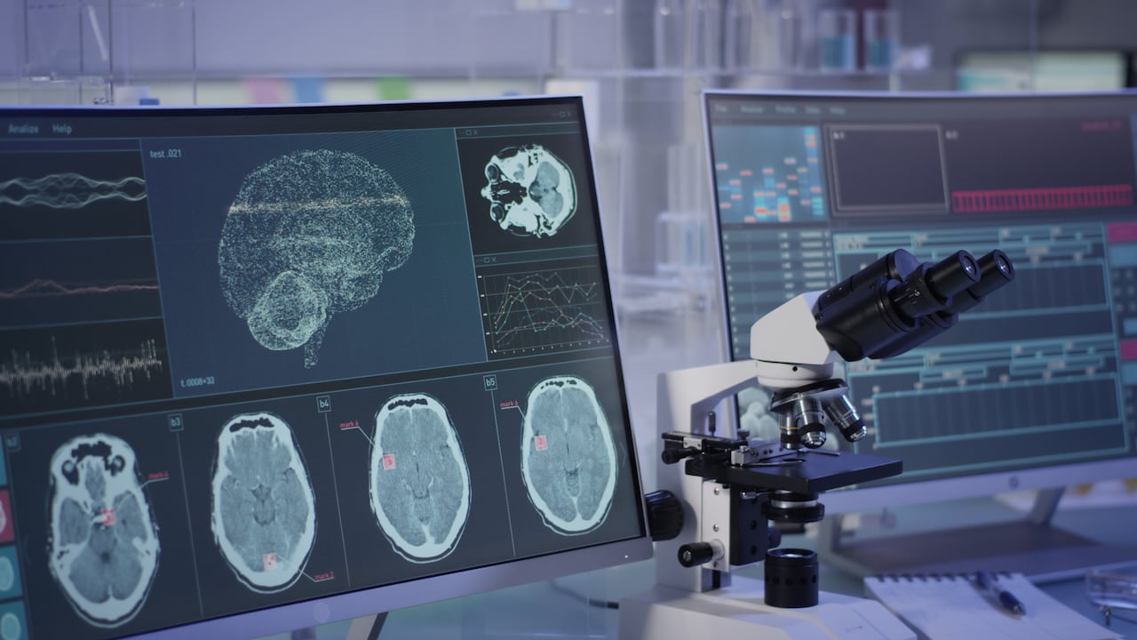 Investigación científica del funcionamiento del cerebro (imagen de referencia).