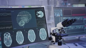 Investigación científica del funcionamiento del cerebro (imagen de referencia).