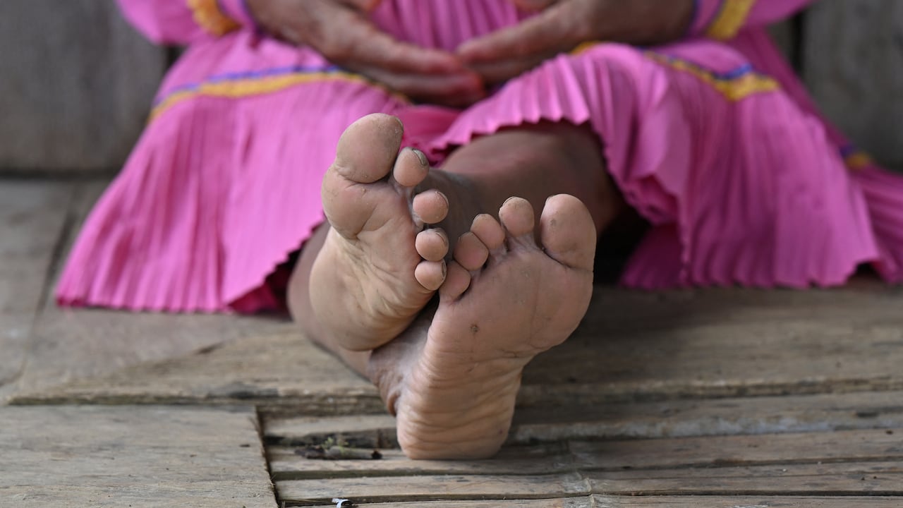 Los casos de mutilación genital femenina se han presentado en comunidades indígenas. FOTO: AFP