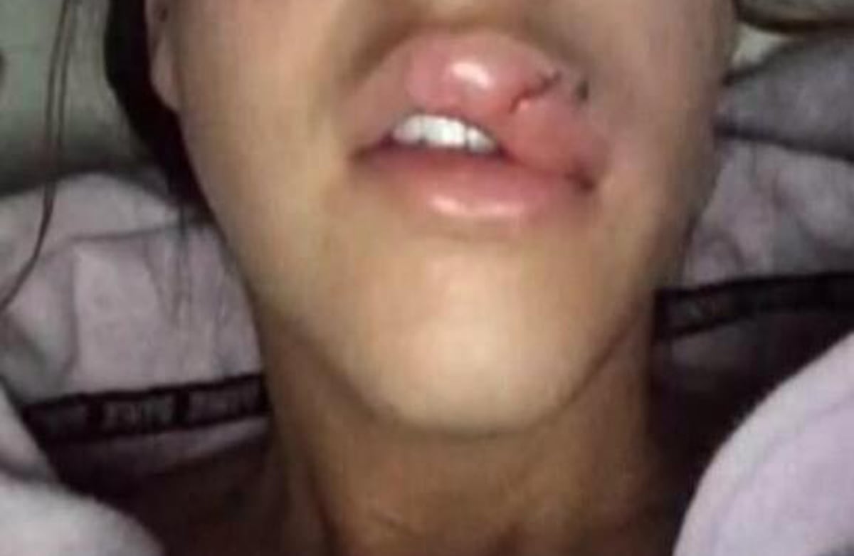 Otra cosecuencia de la práctica peligrosa.