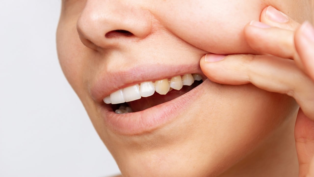 Los dientes amarillos en ocasiones se presentan por el consumo de bebidas como el café o las gaseosas oscuras.