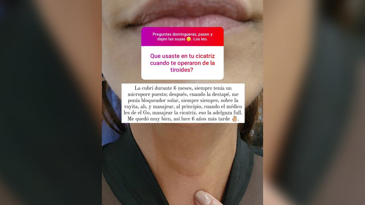 Así luce la cicatriz de Andrea Serna tras 6 años de haberse sometido a una cirugía en la que extirparon las tiroides.