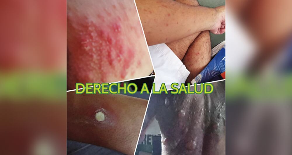     Tuberculosis, neumonía y varicela son las enfermedades más frecuentes en la cárcel. Los reclusos denuncian que no tienen medicamentos.