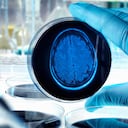 El cerebro también requiere de ciertos cuidados para mantenerse sano.