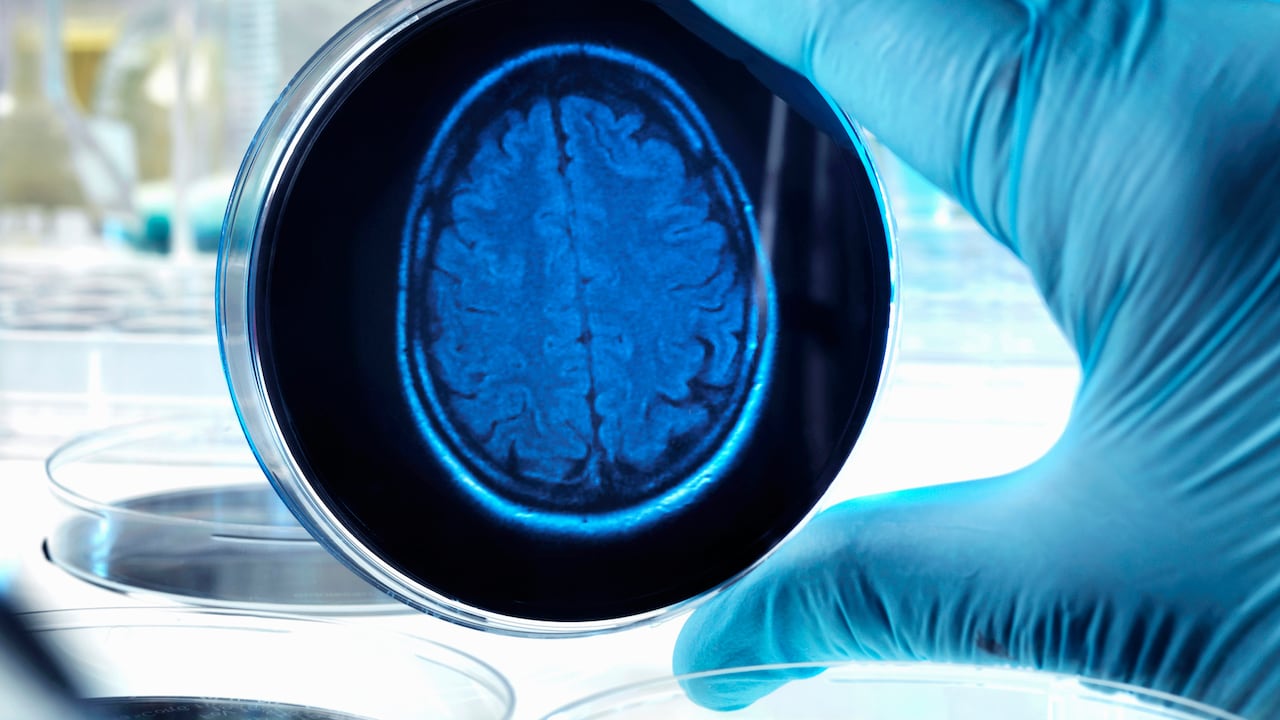 El cerebro también requiere de ciertos cuidados para mantenerse sano.