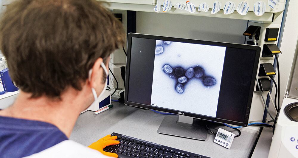 Científicos en Europa ya empiezan a estudiar seriamente la variante de la enfermedad, haciendo más fácil su tratamiento. 