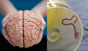 El gusano parásito extraído del cerebro de la mujer medía ocho centímetros.