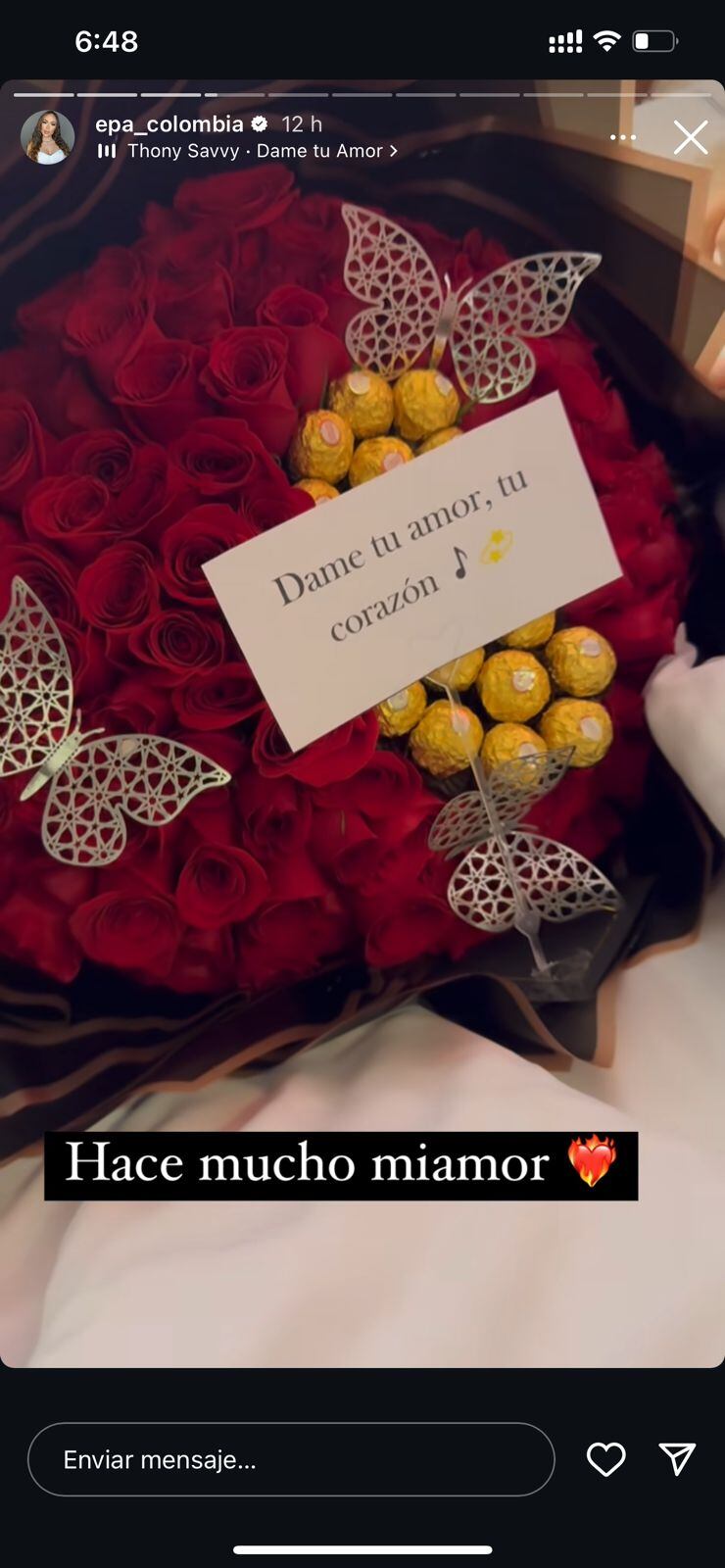 Sorpresa de Karol Samantha a Epa Colombia tras cirugía estética