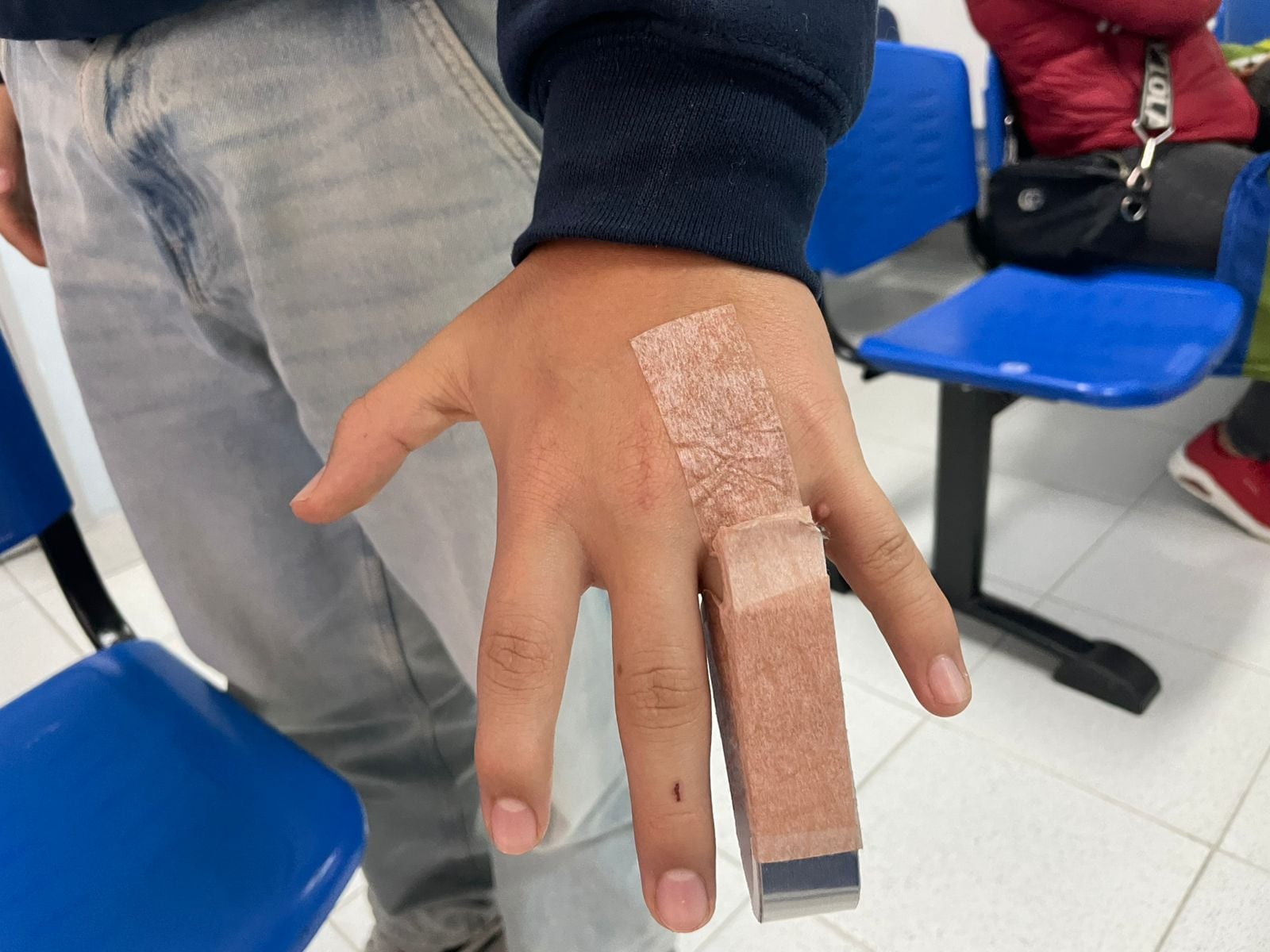 Tres días lleva menor con el dedo fracturado sin ser atendido