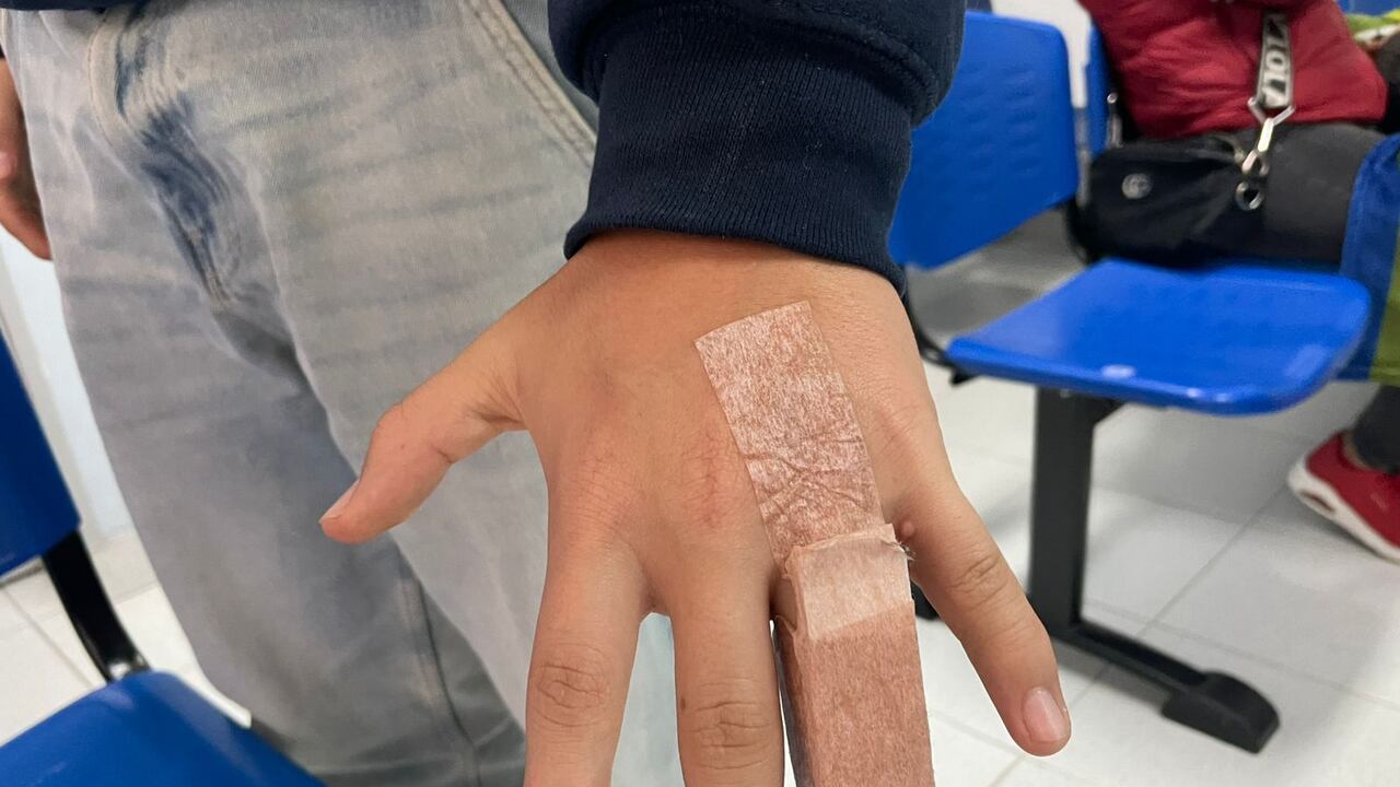 Tres días lleva menor con el dedo fracturado sin ser atendido.