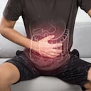 Síndrome del colon irritable.