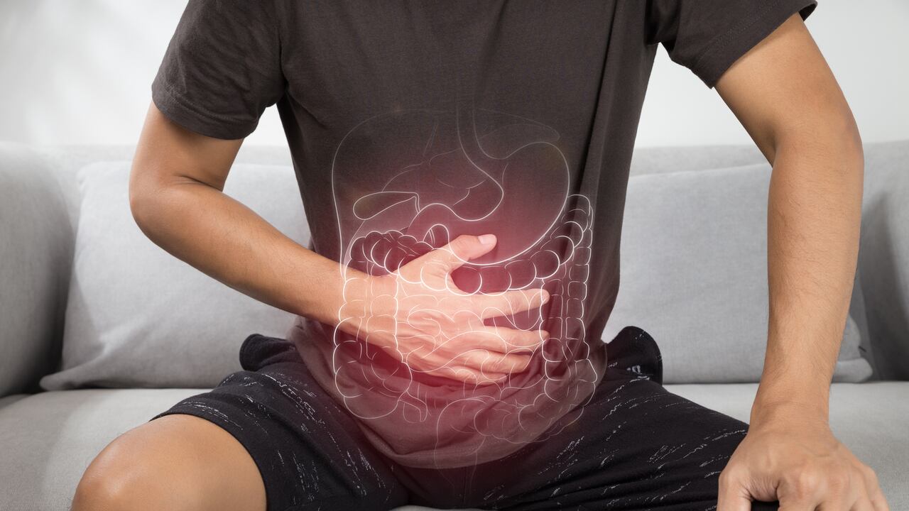 Síndrome del colon irritable.