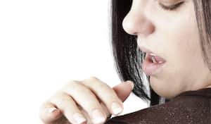 La caspa y la caída del cabello son problemas que afectan tanto a hombres como a mujeres.