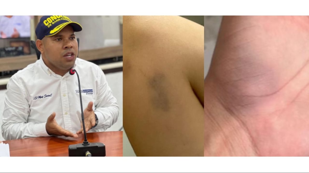 Alexis Castillo, concejal del partido Conservador en Barranquilla.