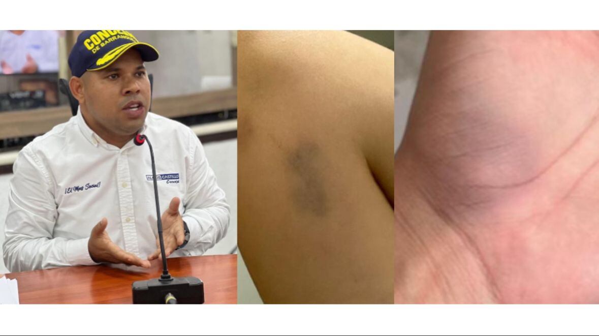 Alexis Castillo, concejal del partido Conservador en Barranquilla.