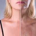 La aplicación de protector solar es indispensable para evitar la aparición de arrugas.